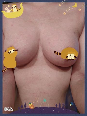 Aca5b5fd0eb5ab84c692d8d7cb3ec283