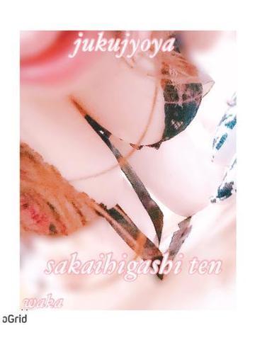 96df84b5d2932881aa3ece2e5b0ebd9f